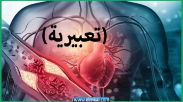 نوبة قلبية آيستوك
