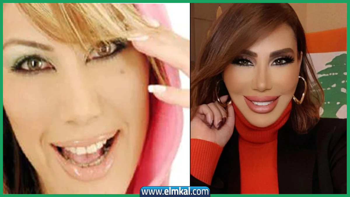 سبب وفاة الإعلامية يمنى شري - المذيعة Youmna Sherry سبب وفاتها وكم عمرها وزوجها وصورها قبل وبعد 4 يمنى شري قبل وبعد